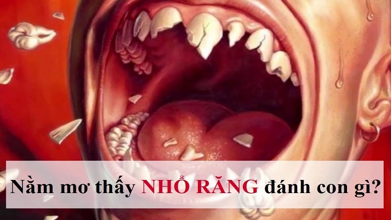 Nằm mơ thấy mình bị gãy răng có ý nghĩa gì?