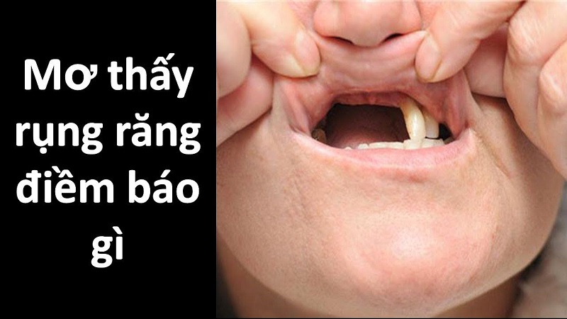 Giải nghĩa về giấc ngủ bị gãy răng, có ý nghĩa gì?