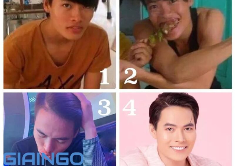Sự Thật Phẫu Thuật Thẩm Mỹ Võ Tấn Phát