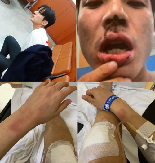 Seungri là ai?